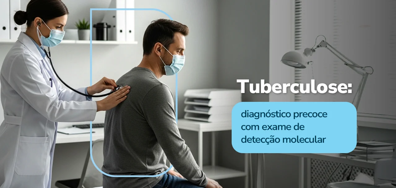 Exame de detecção molecular de Mycobacterium spp (PPD)