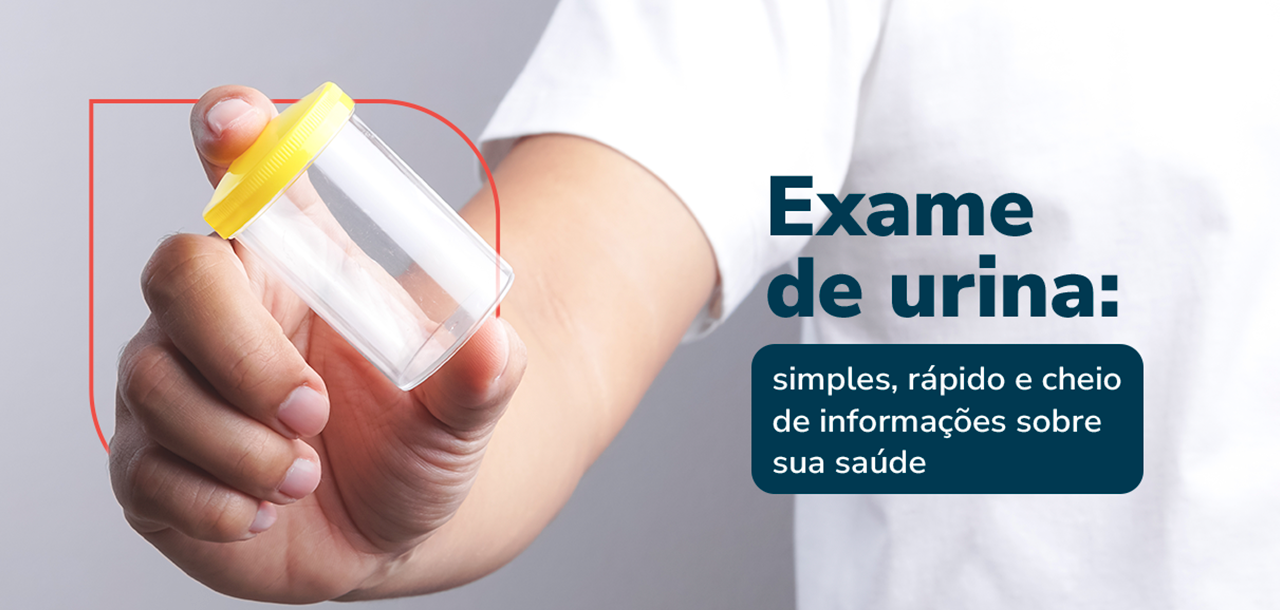 Exame de urina: o que detecta