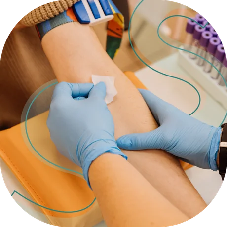 exame anti-tireoglobulina