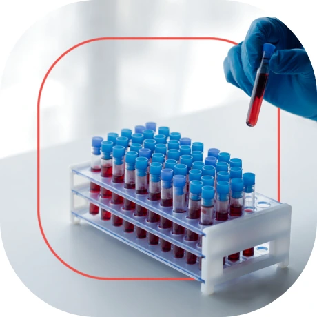 Exame Gama-Glutamil Transferase